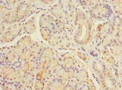 TBC1D19 Antibody