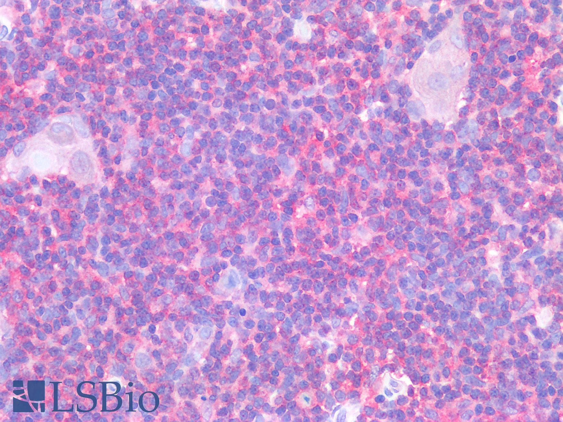 IHC-plus™ CD33 Antibody