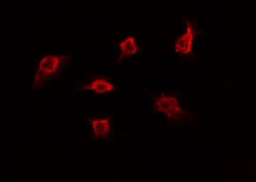 POU3F1 / OCT6 Antibody