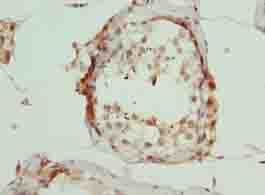 ARMT1 Antibody