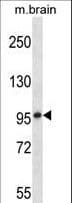 Polyclonal Rabbit anti-Mouse MARK1 / MARK Antibody (aa600-627, WB)