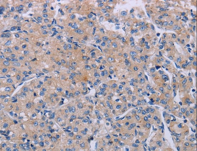 P2RX3 / P2X3 Antibody