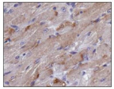 TIGAR Antibody