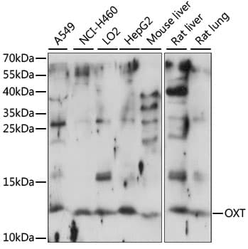 Polyclonal Rabbit anti-Human Oxytocin Antibody (WB)