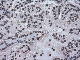HSPA9 / Mortalin / GRP75 Antibody (clone OTI9F8)