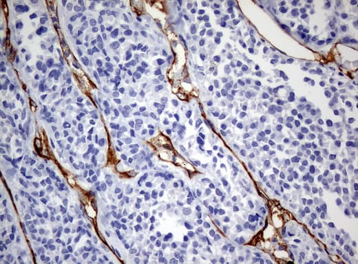 PECAM-1 / CD31 Antibody (clone UMAB32, Carrier-free)