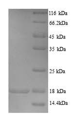 Human SARAF / TMEM66 Protein (Recombinant 6His, N-terminus)