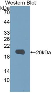 MMP9 / Gelatinase B Antibody (aa213-399)