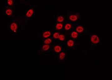 RAD54L Antibody