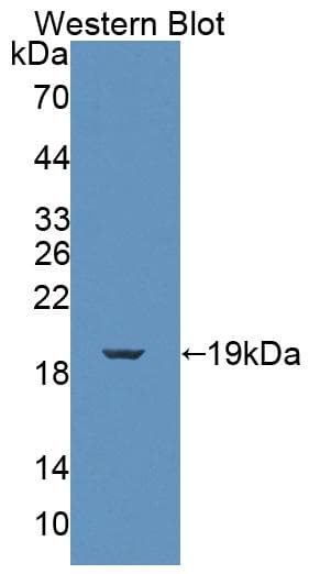 FKBP2 Antibody (aa1-142, APC)