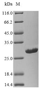 La Crosse Virus SARS-CoV Nucleoprotein (Recombinant 6His, N-terminus)