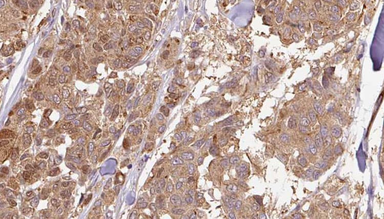 CYB5R4 Antibody