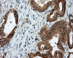 LIPG / Endothelial Lipase Antibody (clone OTI8F8)
