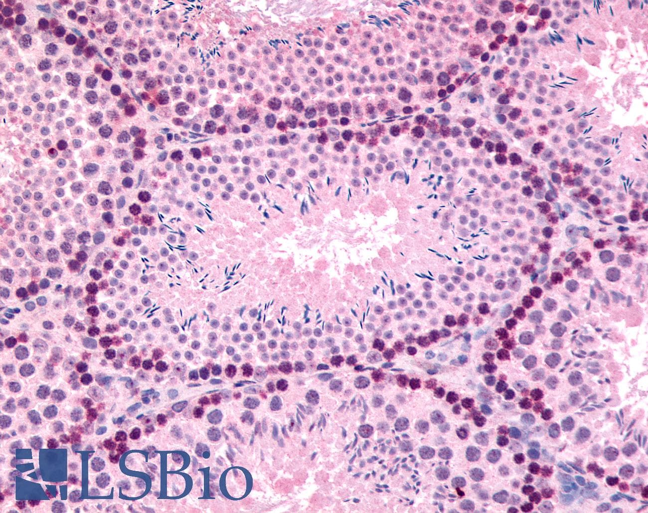 IHC-plus™ GLI2 Antibody (Internal)
