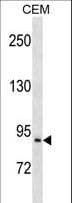 Polyclonal Rabbit anti-Human PREP / Prolyl Endopeptidase Antibody (aa293-322, WB)