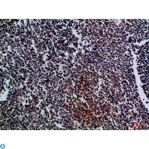 CD27L / CD70 Antibody