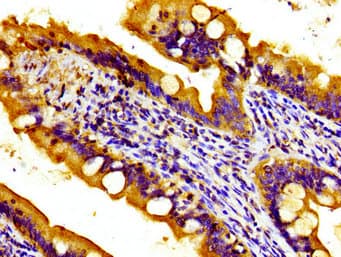 TOB1 / TOB Antibody