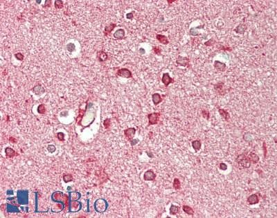 IHC-plus™ RALDH2 / ALDH1A2 Antibody (C-Terminus)