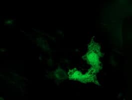 IHC-plus™ Monoclonal Mouse anti-Human TUBB4 / Tubulin Beta 4 Antibody (clone 6C2, IHC, IF, WB)