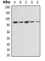 FAP Alpha Antibody (Internal)