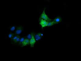 CTAG1B / NY-ESO-1 Antibody (clone OTI2A10)