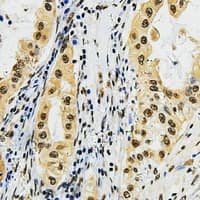 Polyclonal Rabbit anti-Human DAT1 / LMO3 Antibody (C-Terminus, IHC, WB)