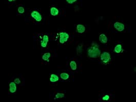 HOXC11 Antibody (clone OTI2A10)