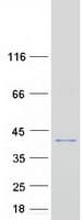 Human EPSTI1 Protein (Recombinant Myc-DDK (Flag))