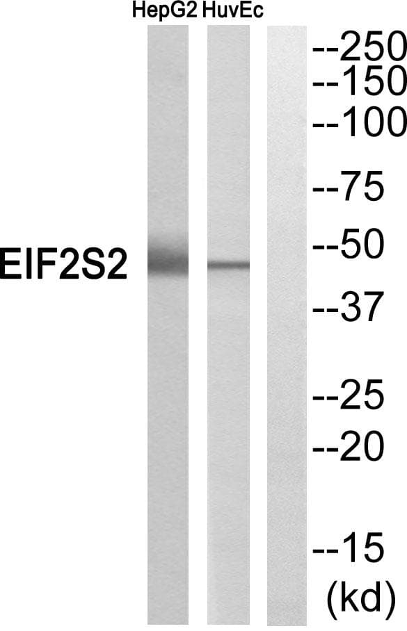 Polyclonal Rabbit anti-Human EIF2S2 Antibody (WB)