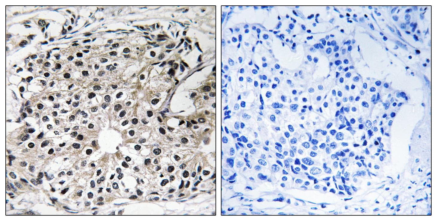 Polyclonal Rabbit anti-Human ECI2 / PECI Antibody (IHC, WB)