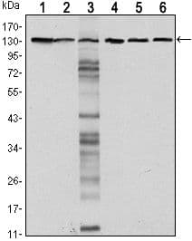 CDH1 / E Cadherin Antibody (clone 7A2)