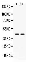 Polyclonal Rabbit anti-Human ADA / Adenosine Deaminase Antibody (IHC, WB)