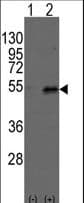 Polyclonal Rabbit anti-Mouse DTNBP1 / Dysbindin Antibody (aa296-325, IHC, WB)