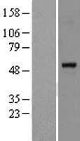 Human PPARA / PPAR Alpha Protein (Over-Expression Lysate Myc-DDK (Flag))