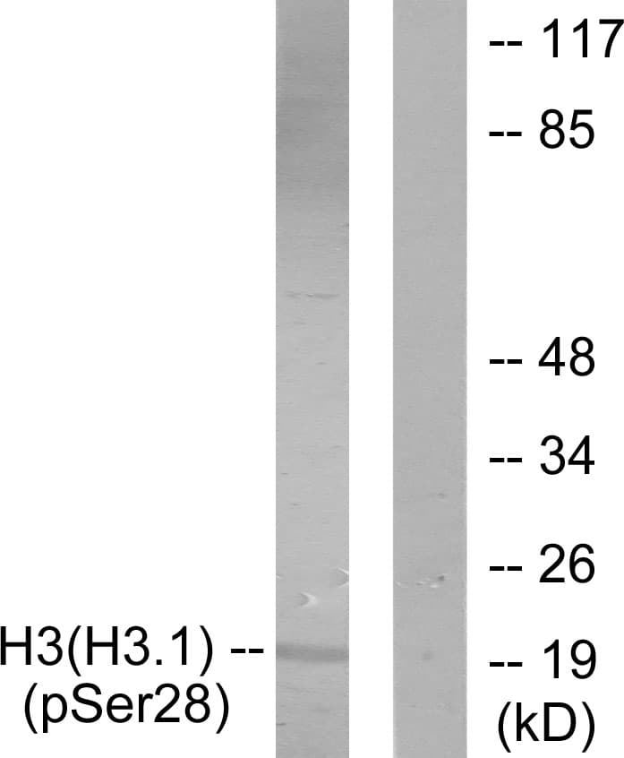 Histone H3 Antibody (phospho-Ser28)