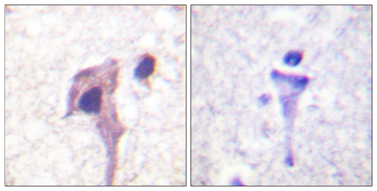 Polyclonal Rabbit anti-Human SYN1 / Synapsin 1 Antibody (aa26-75, IHC, WB)