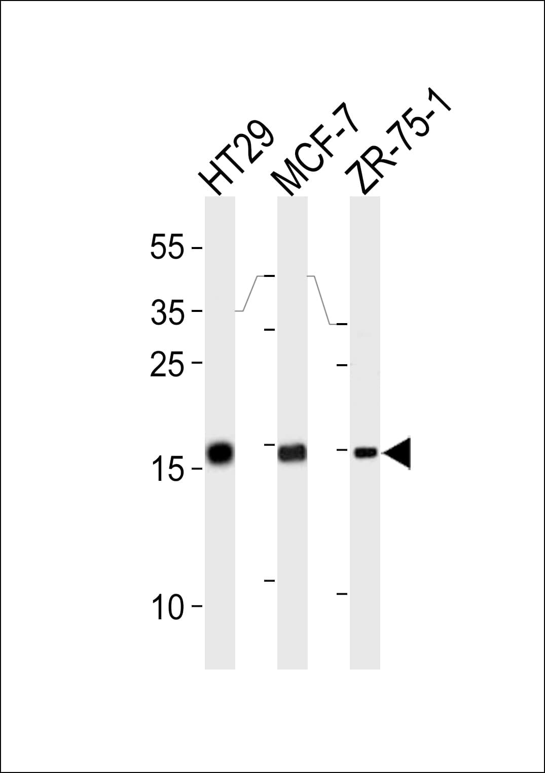 AGR2 Antibody (aa13-42)