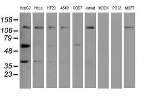 IGF2BP2 Antibody (clone OTI4D10)