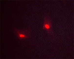 TP53 / p53 Antibody (phospho-Ser392)