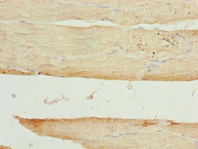 Polyclonal Rabbit anti-Human ARSG / Arylsulfatase G Antibody (aa17-525)
