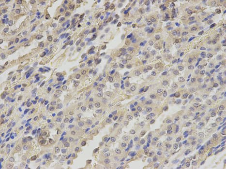 Polyclonal Rabbit anti-Human TXNRD2 Antibody (IHC, WB)
