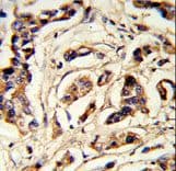 TSHB / TSH-Beta Antibody (aa58-86)