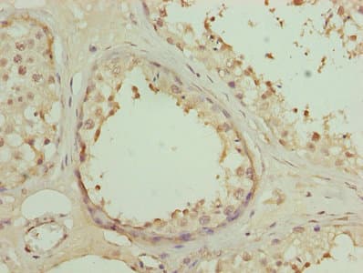 DSCR9 Antibody (aa1-149)