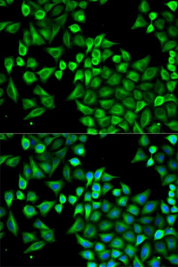 IHC-plus™ ABAT Antibody