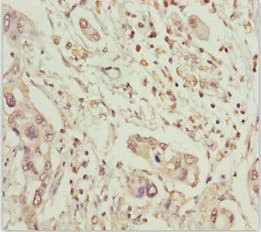 MCCC2 / MCCB Antibody