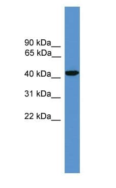 Polyclonal Rabbit anti-Human SYT5 Antibody (aa151-200, WB)