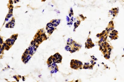 SYN / FYN Antibody (Thr524)