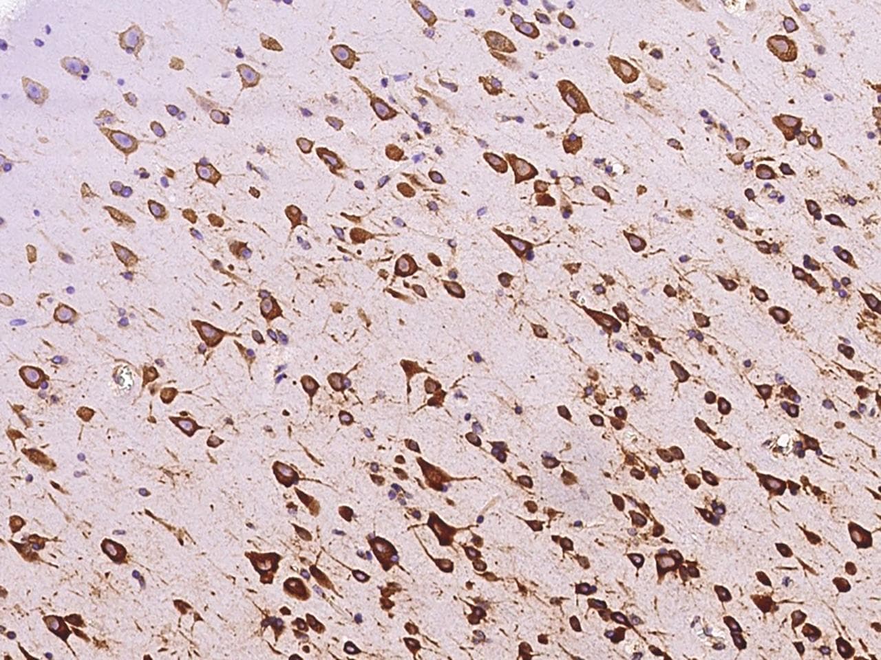 Polyclonal Rabbit anti-Human RPS5 / Ribosomal Protein S5 Antibody (IHC, IF, WB)