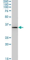 SDR9C1 / BDH1 Antibody (clone 4B3)