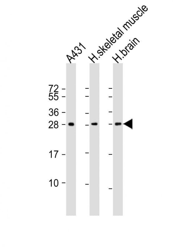 Monoclonal Mouse anti-Human DENR / Density Regulated Antibody (clone 1542CT106.51.79, IHC, IF, WB)